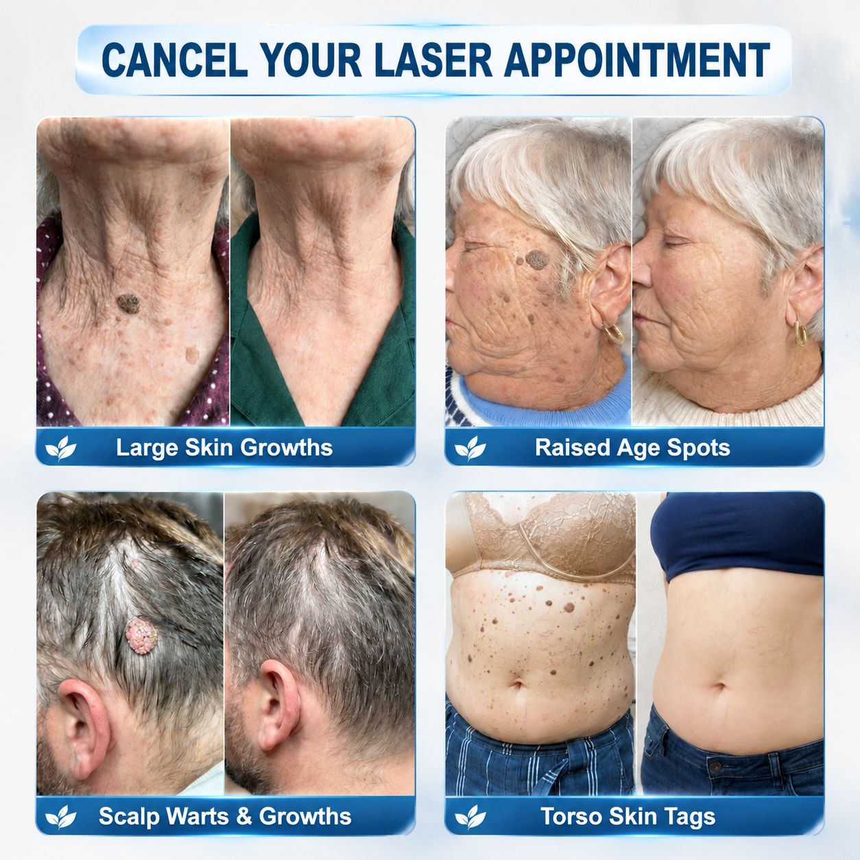 Only 5 boxes of Hiskin® left in stock! Enjoy an extra 80% discount! Get a natural, glowing tan. This opportunity won’t come again until next year.