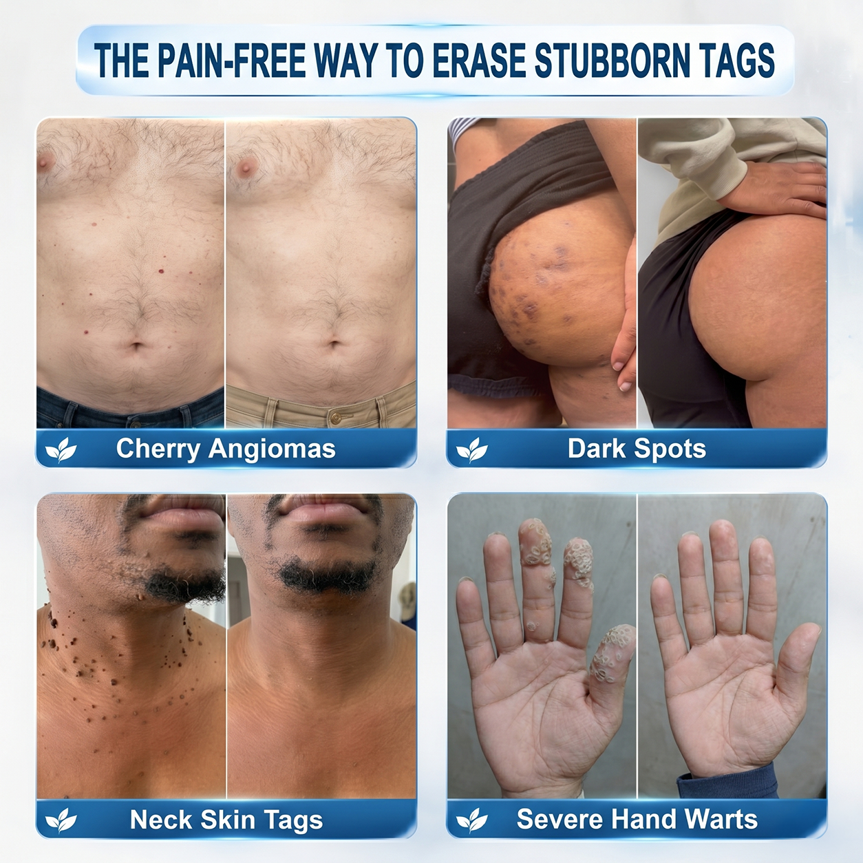 Only 5 boxes of Hiskin® left in stock! Enjoy an extra 80% discount! Get a natural, glowing tan. This opportunity won’t come again until next year.