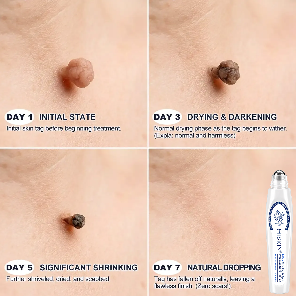 Only 5 boxes of Hiskin® left in stock! Enjoy an extra 80% discount! Get a natural, glowing tan. This opportunity won’t come again until next year.
